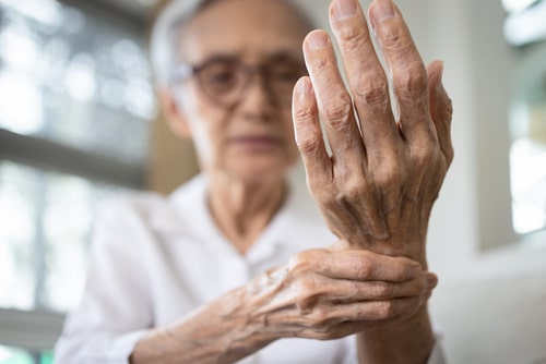 Lady holding hand with arthritis pain