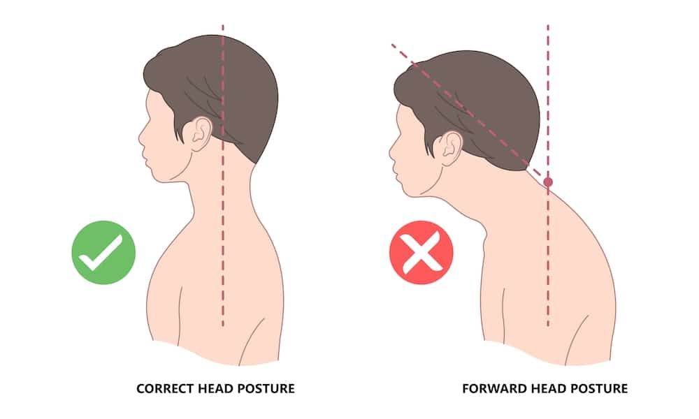 Diagram of incorrect head posture